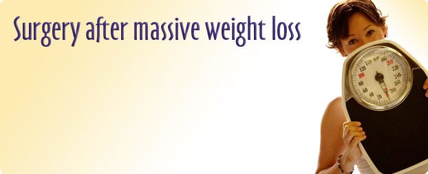 Post wieght loss surgery Little Rock, AR by Dr. Devlin at Devlin cosmetic Surgery photo